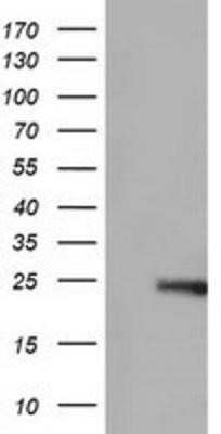 Western Blot: RhoGDI Antibody (OTI1F2)Azide and BSA Free [NBP2-73890]