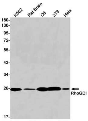 Western Blot: RhoGDI Antibody (S05-6F6) [NBP3-15089]