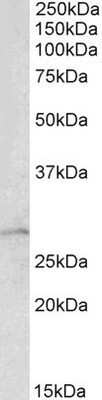 Western Blot: RhoGDI Antibody [NBP1-52064]