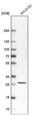 Western Blot: RhoGDI Antibody [NBP1-92333]