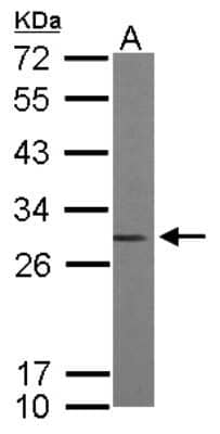 Western Blot: RhoGDI Antibody [NBP2-20159]