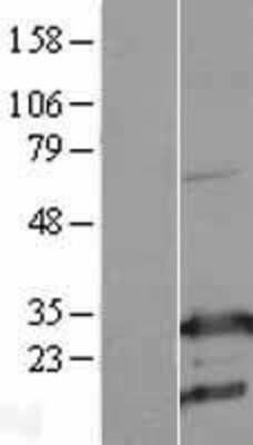 Western Blot: RhoGDI Overexpression Lysate [NBL1-07673]