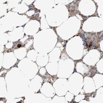 Immunohistochemistry-Paraffin: RhoH Antibody [NBP1-88816]