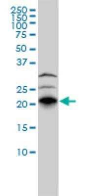 Western Blot: RhoJ Antibody (1E4) [H00057381-M01]