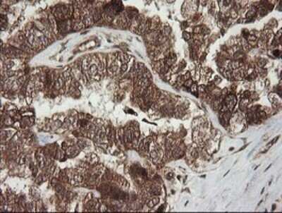 Immunohistochemistry: RhoJ Antibody (OTI1D7) - Azide and BSA Free [NBP2-73892]