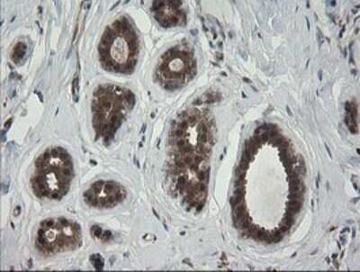 Immunohistochemistry: RhoJ Antibody (OTI1D7) - Azide and BSA Free [NBP2-73892]