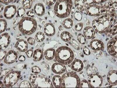 Immunohistochemistry: RhoJ Antibody (OTI1D7) - Azide and BSA Free [NBP2-73892]