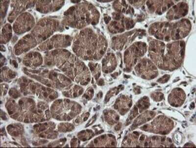 Immunohistochemistry: RhoJ Antibody (OTI1D7) - Azide and BSA Free [NBP2-73892]