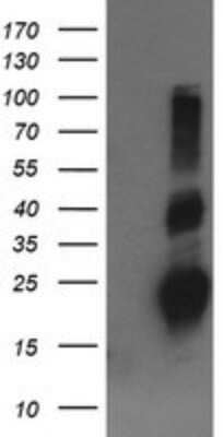 Western Blot: RhoJ Antibody (OTI1D7)Azide and BSA Free [NBP2-73892]