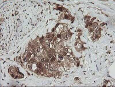 Immunohistochemistry: RhoJ Antibody (OTI1D7) [NBP2-45590]