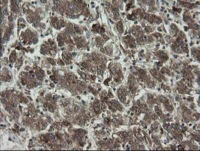 Immunohistochemistry: RhoJ Antibody (OTI1D7) [NBP2-45590]