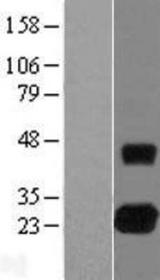 Western Blot: RhoJ Overexpression Lysate [NBL1-15358]