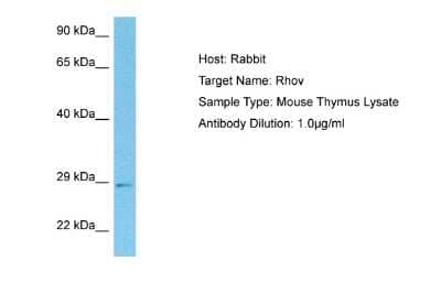 Western Blot: RhoV Antibody [NBP2-85635]