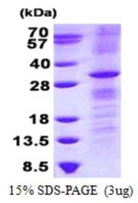 SDS-PAGE: Recombinant Human RhoV His Protein [NBP2-23400]