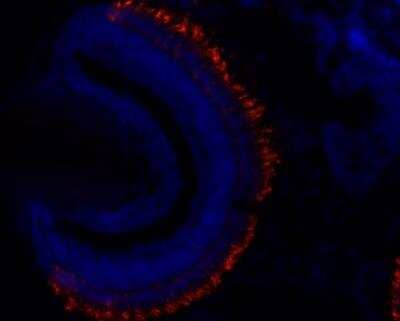 Immunohistochemistry-Frozen: Rhodopsin Antibody (4D2) [NBP2-59690]