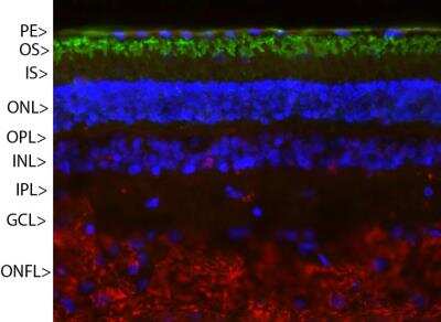 Immunocytochemistry/ Immunofluorescence: Rhodopsin Antibody (A531) [NBP2-25159]