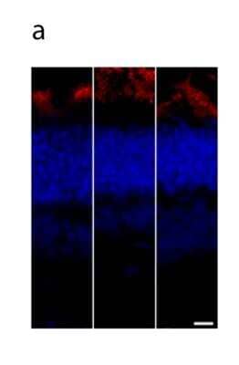 Immunohistochemistry: Rhodopsin Antibody (B630) [NBP2-25160]