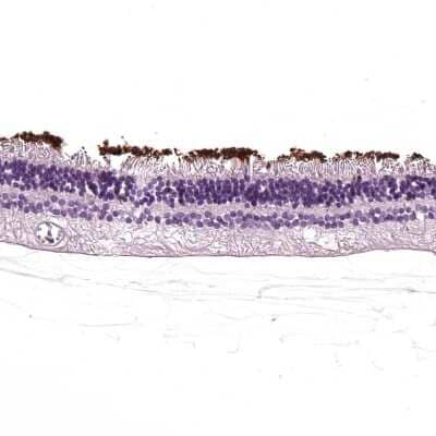 Immunohistochemistry-Paraffin: Rhodopsin Antibody [NBP2-55553]