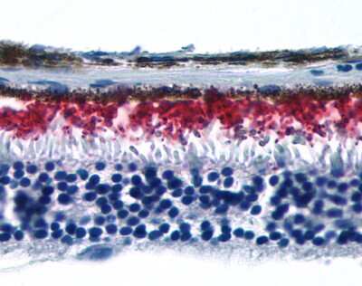 Immunohistochemistry-Paraffin: Rhodopsin Antibody - BSA Free [NLS1052]