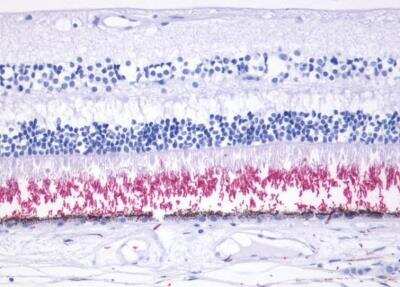 Immunohistochemistry-Paraffin: Rhodopsin Antibody - BSA Free [NLS1052]