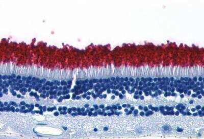 Immunohistochemistry-Paraffin: Rhodopsin Antibody - BSA Free [NLS1052]