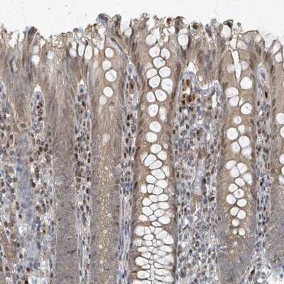 Immunohistochemistry-Paraffin: Rhophilin 2 Antibody [NBP2-13231]