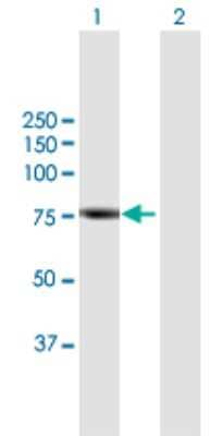 Western Blot: Rhophilin 2 Antibody [H00085415-B01P]