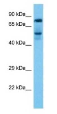 Western Blot: Rhophilin 2 Antibody [NBP3-09401]