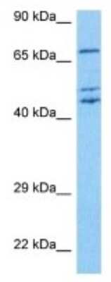 Western Blot: Rhophilin 2 Antibody [NBP3-10020]