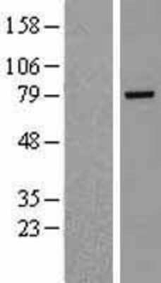 Western Blot: Rhophilin 2 Overexpression Lysate [NBL1-15364]