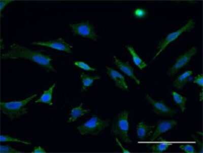 Immunocytochemistry/ Immunofluorescence: Rhot1 Antibody (1A12) [H00055288-M02]