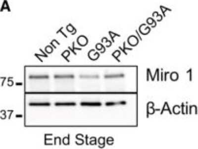 Western Blot: Rhot1 Antibody (4H4) [H00055288-M01]