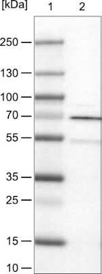 Western Blot: Rhot1 Antibody (CL1083) [NBP2-52964]