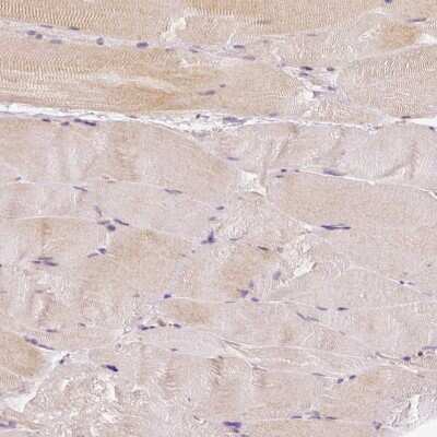 Immunohistochemistry-Paraffin: Rhot1 Antibody (CL1095) [NBP2-52965]