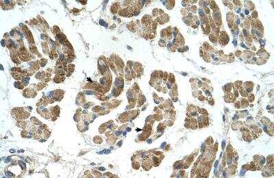 Immunohistochemistry-Paraffin: Rhot1 Antibody [NBP1-59021]