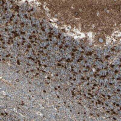 Immunohistochemistry-Paraffin: Rhot1 Antibody [NBP1-89011]