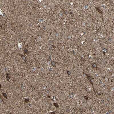 Immunohistochemistry-Paraffin: Rhot1 Antibody [NBP1-89011]