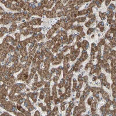 Immunohistochemistry-Paraffin: Rhot1 Antibody [NBP1-89011]