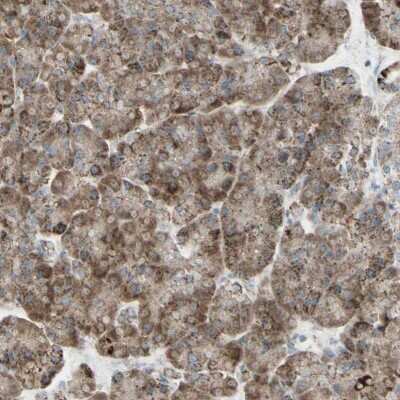 Immunohistochemistry-Paraffin: Rhot1 Antibody [NBP1-89011]