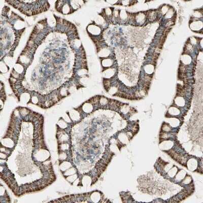 Immunohistochemistry-Paraffin: Rhot1 Antibody [NBP1-89011]