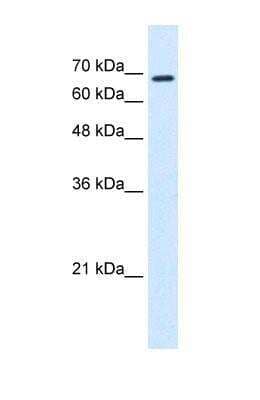 Western Blot: Rhot1 Antibody [NBP1-59021]