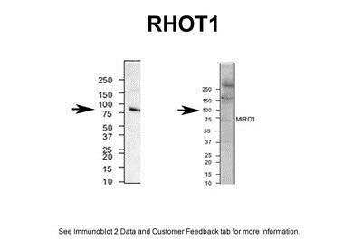 Western Blot: Rhot1 Antibody [NBP1-59021]