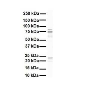 Western Blot: Rhot1 Antibody [NBP1-59021]