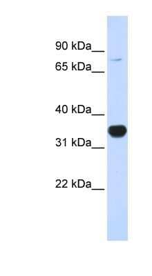 Western Blot: Rhot1 Antibody [NBP1-59609]