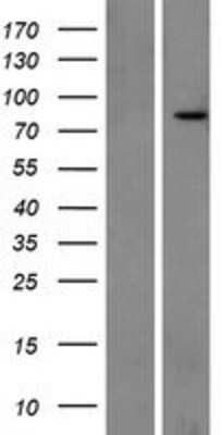 Western Blot: Rhot1 Overexpression Lysate [NBP2-08624]