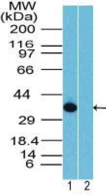 Western Blot: Rhox10 Antibody [NBP2-23834]