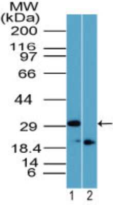 Western Blot: Rhox11 Antibody [NBP2-23830]