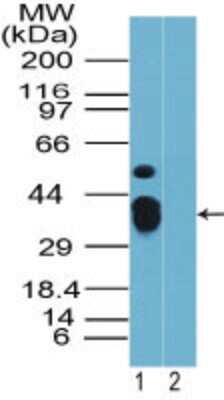 Western Blot: Rhox9 Antibody [NBP2-23844]