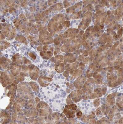 Immunohistochemistry-Paraffin: Ribonuclease A Antibody [NBP1-87804]