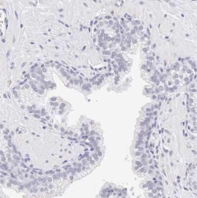 Immunohistochemistry-Paraffin: Ribonuclease A Antibody [NBP1-87804]